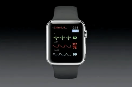 Apple Watch допомагає вагітним