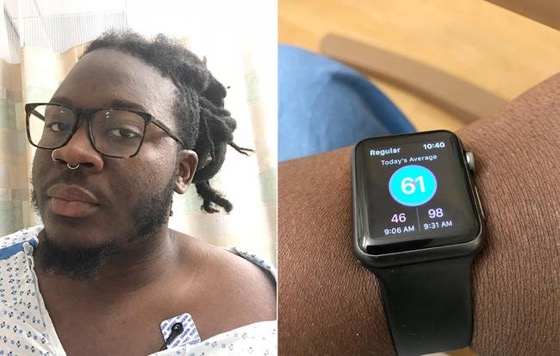Apple Watch врятував чоловіка із тромбом
